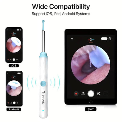 Smart Visual Ear Wax Cleaner with HD Camera | WiFi Otoscope with USB-C Charging